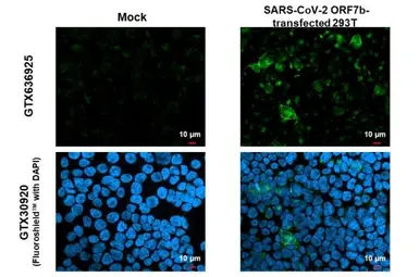 Anti-SARS-CoV-2 (COVID-19) ORF7b antibody [HL1453] used in Immunocytochemistry/ Immunofluorescence (ICC/IF). GTX636925